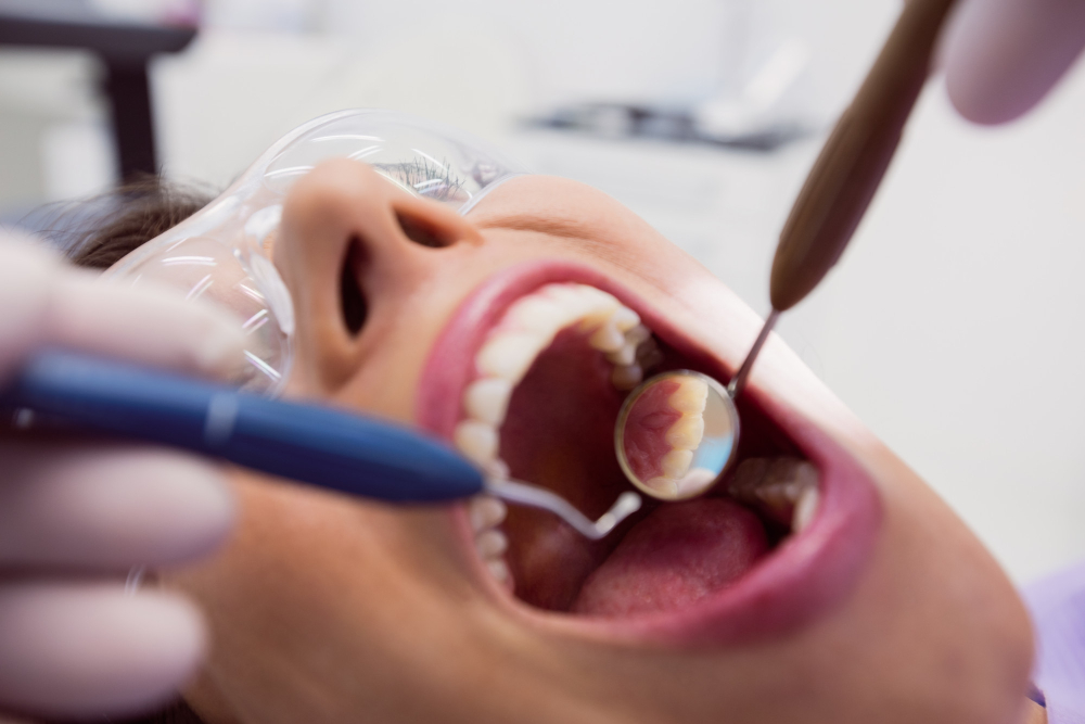 Protez Diş Nedir ve Türleri Nelerdir?