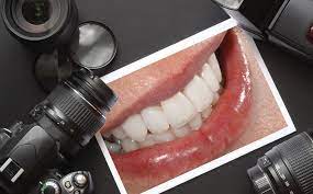Sağlık ve Estetiğin Buluştuğu Nokta: Dental Fotoğrafçılığın Diş Tedavilerindeki Etkisi